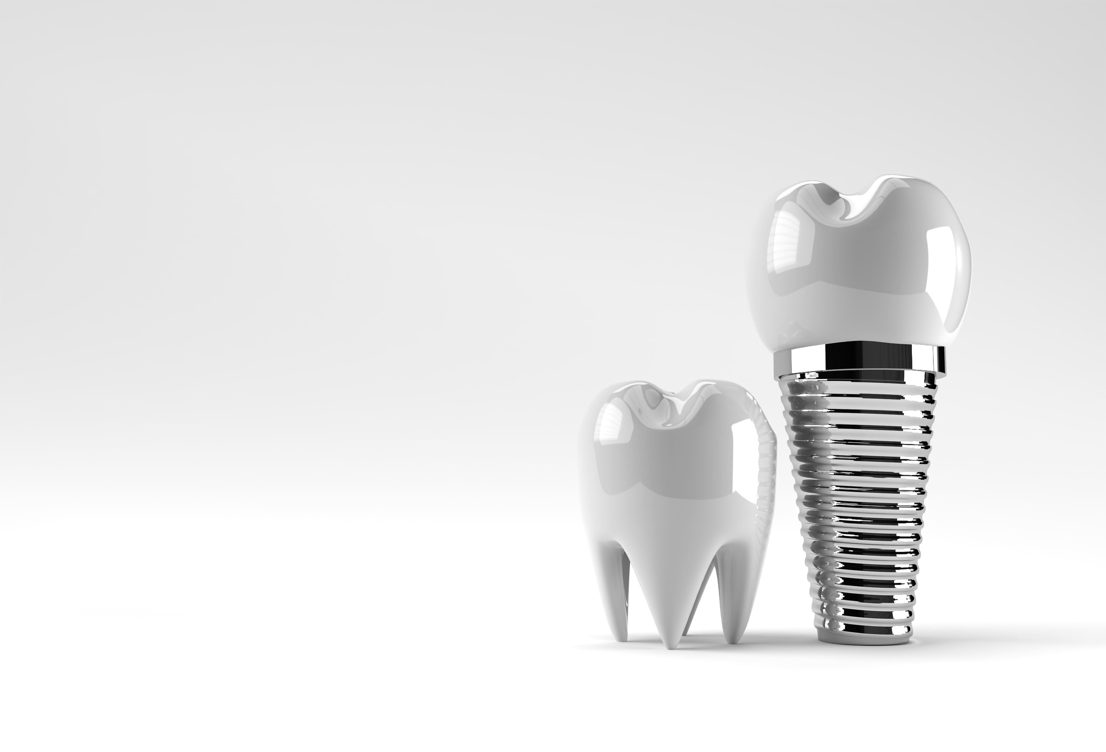 Implant Leidschendam