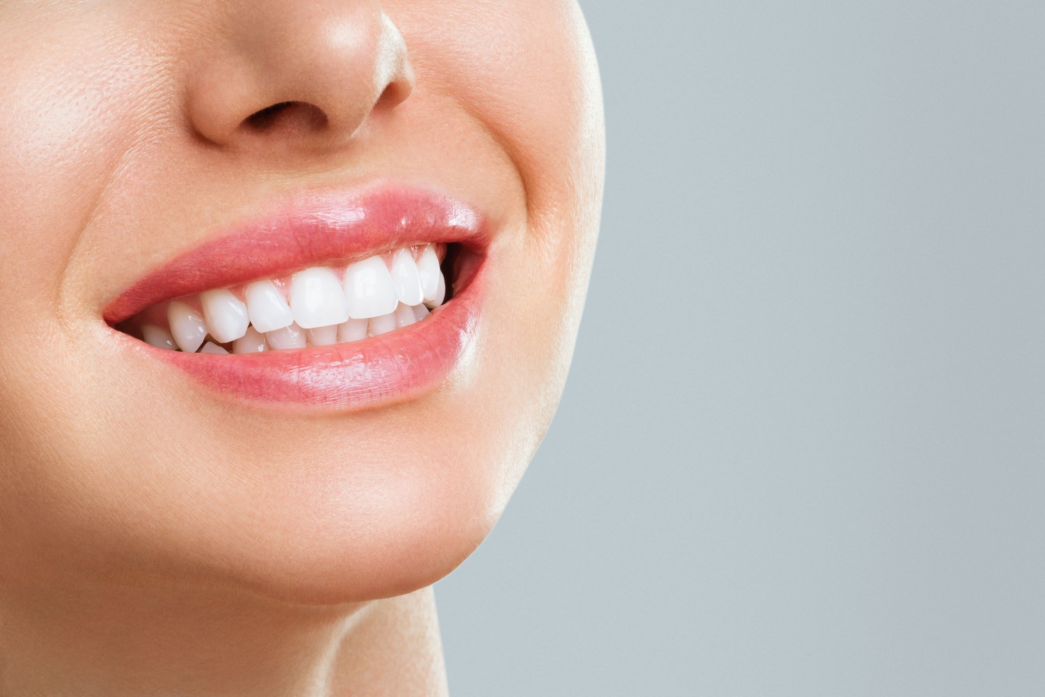 teeth-whitening-in-leidschendam